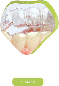 矯正歯科・マウスピース型矯正